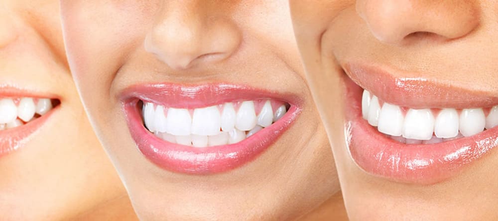 آنچه باید در رابطه با سلامت دهان و دندان بدانید 3